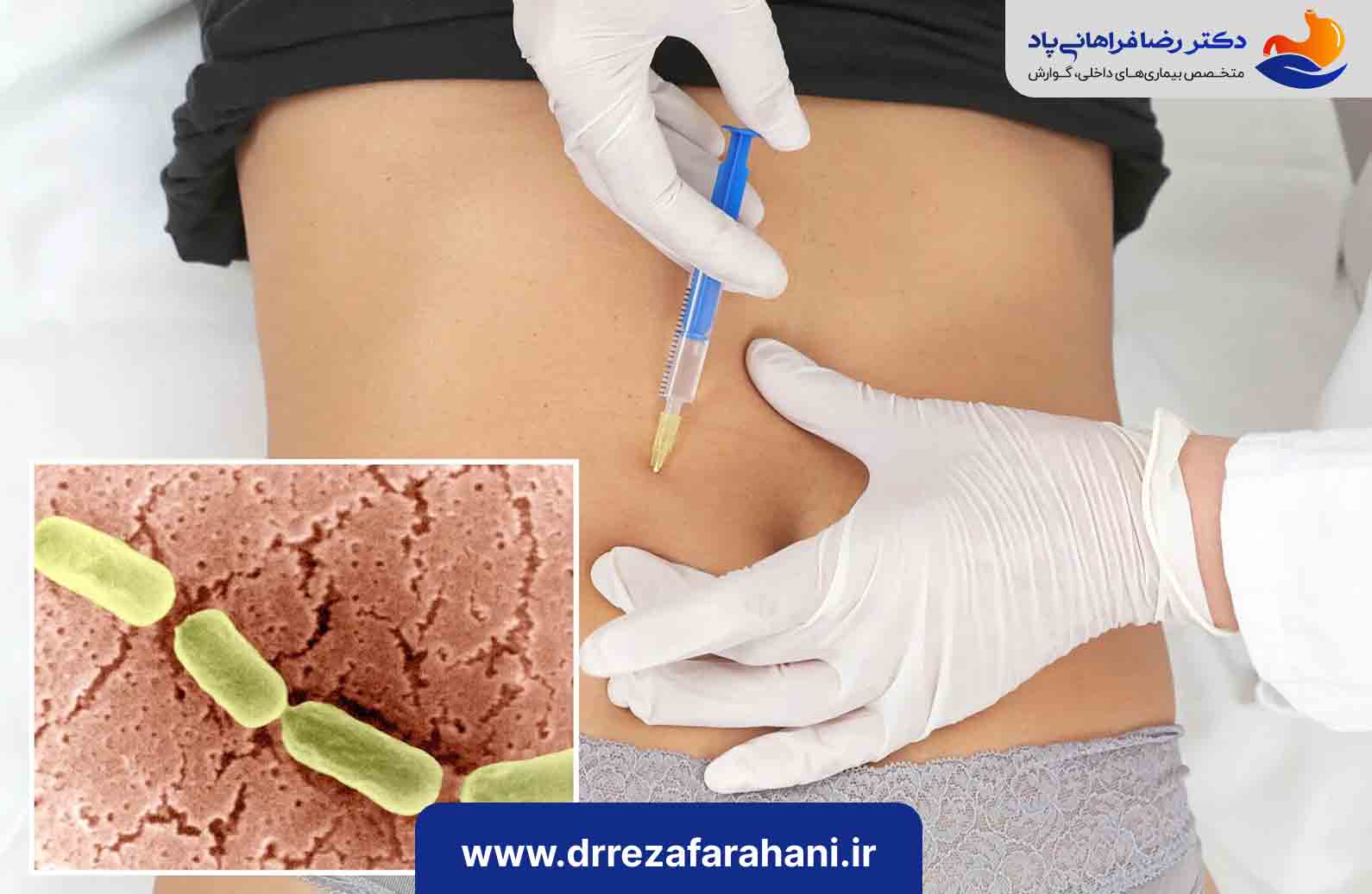 آیا بوتاکس معده برای شما مناسب است؟