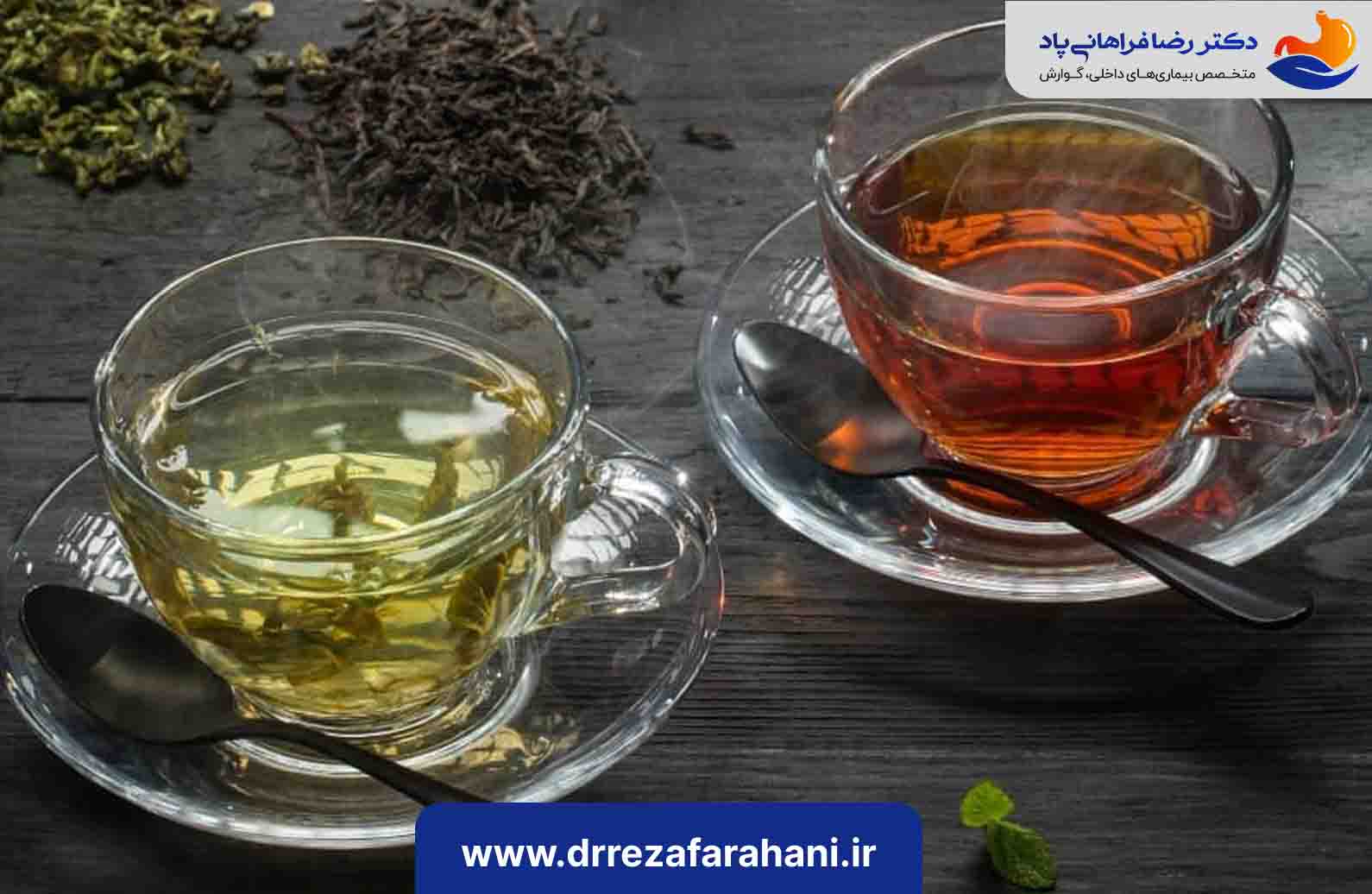رژیم غذایی بعد از بوتاکس معده