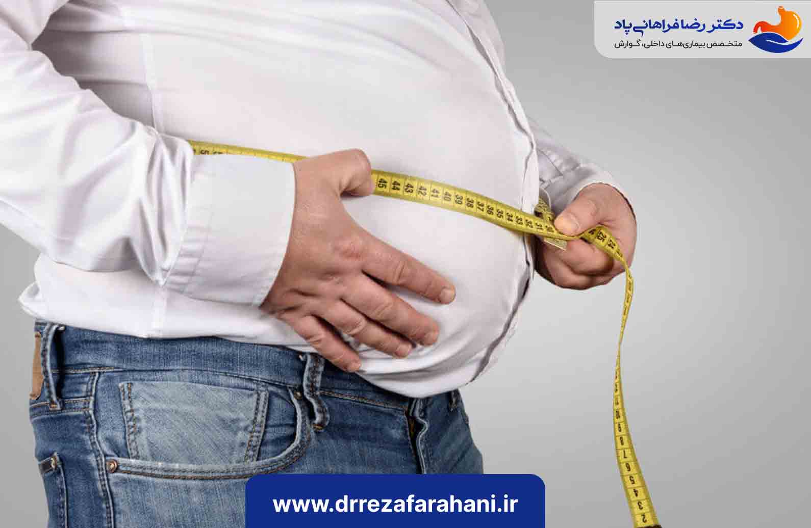 پوشش بیمه‌ای بوتاکس معده
