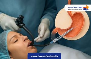 روند عمل بوتاکس معده