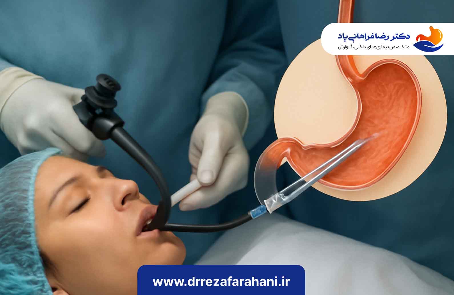 روند عمل بوتاکس معده
